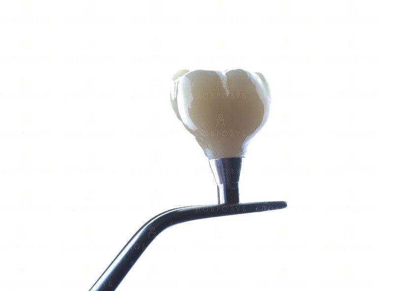 Протезування зубів Київ | Фото 1 - Стоматологія Доброзуб